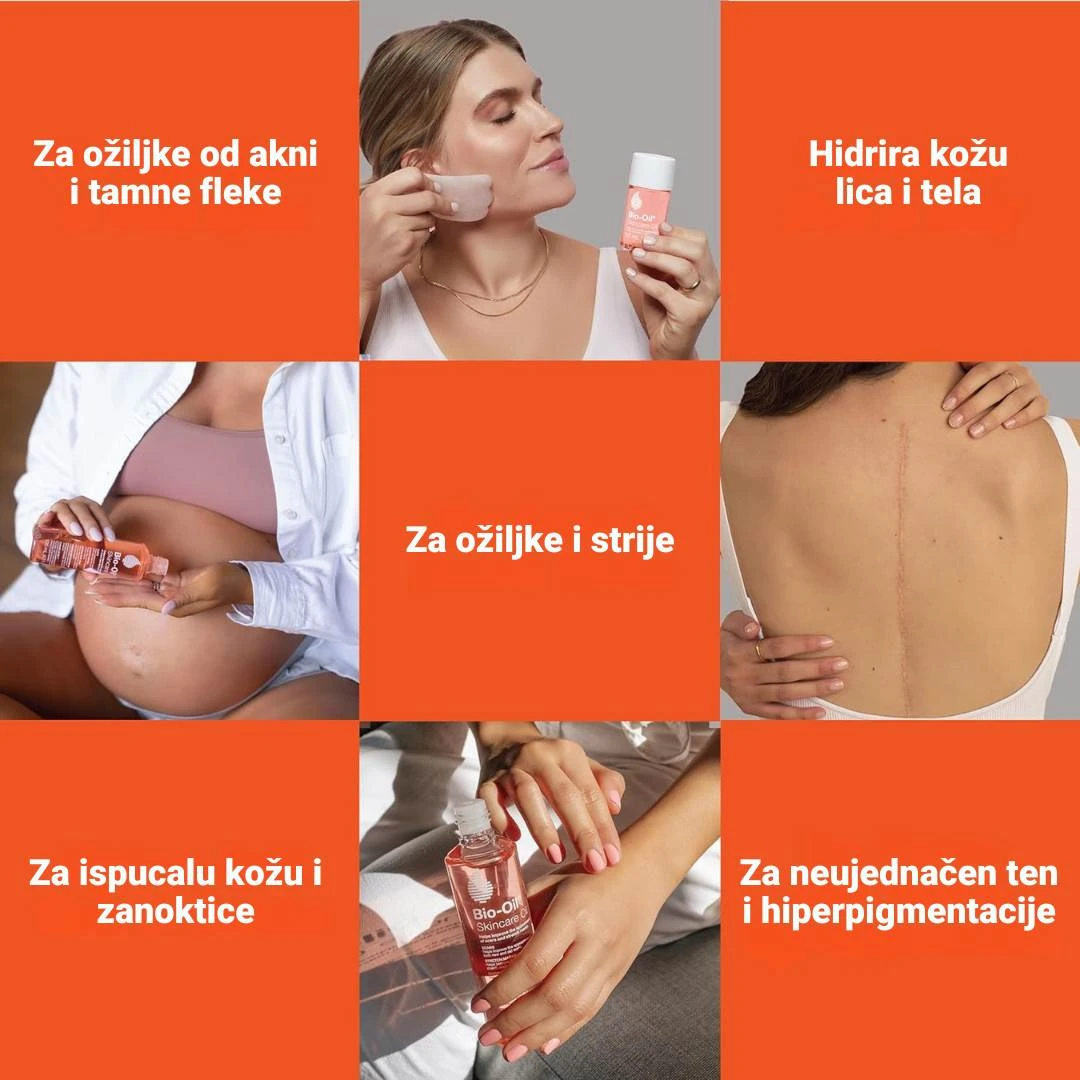 Bio-Oil® Ulje za Negu Kože 125 mL Suvo Ulje BioOil