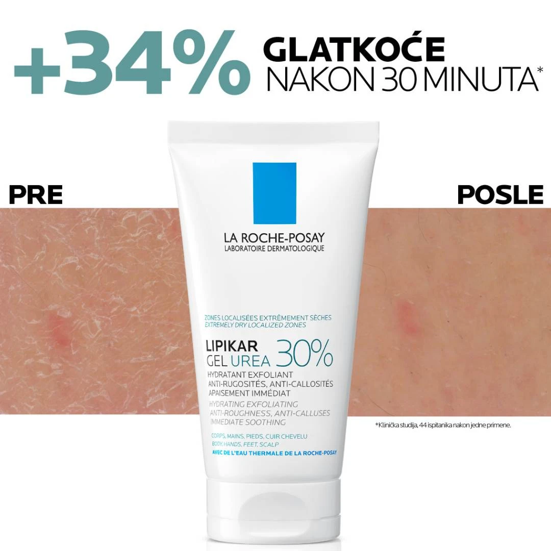 LRP LIPIKAR Gel Urea 30% 50 mL za Suvu i Grubu Kožu; Urea; Niacinamid