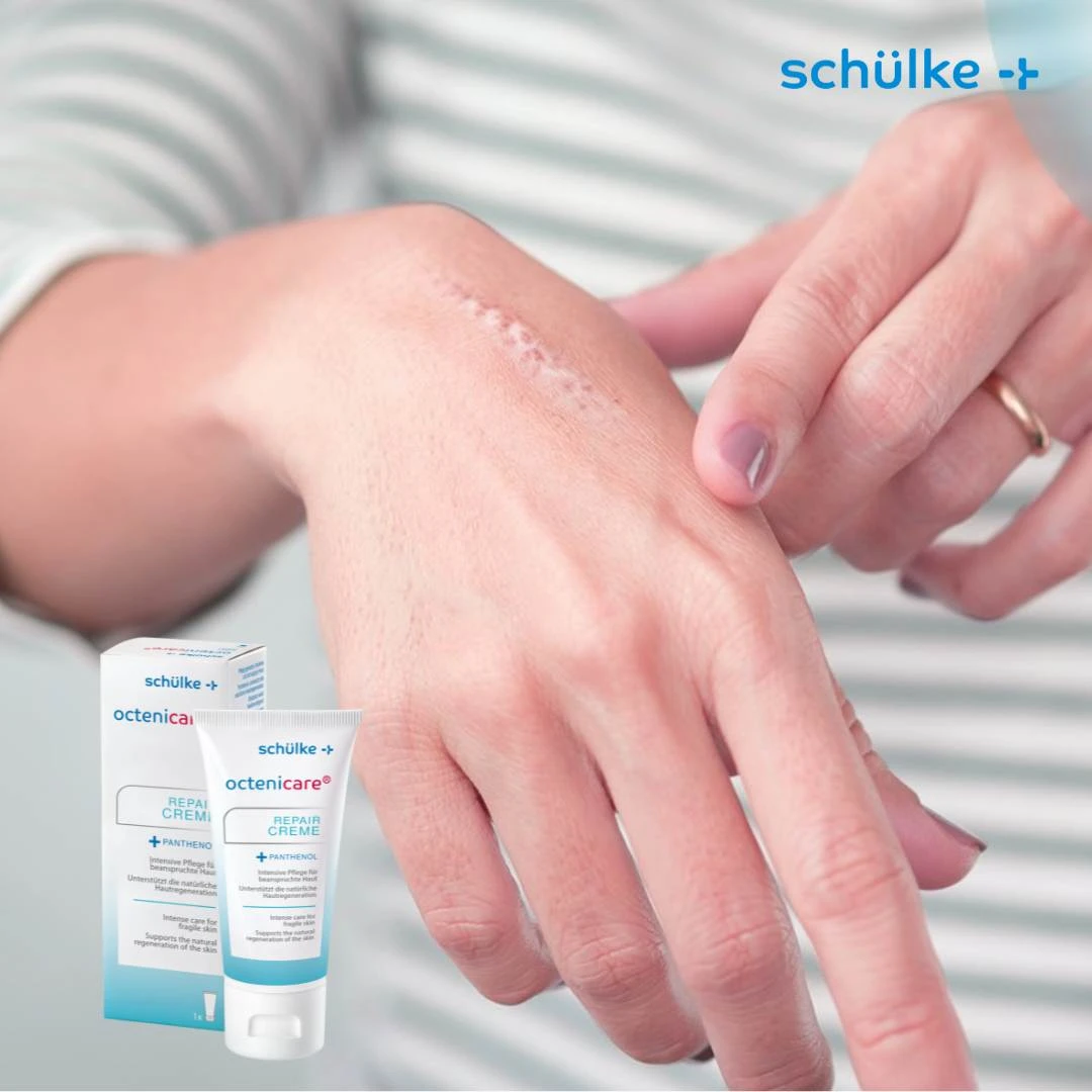 Schülke Octenicare® Obnavljajuća Krema za Regeneraciju Oštećene i Iritirane Kože 50 mL