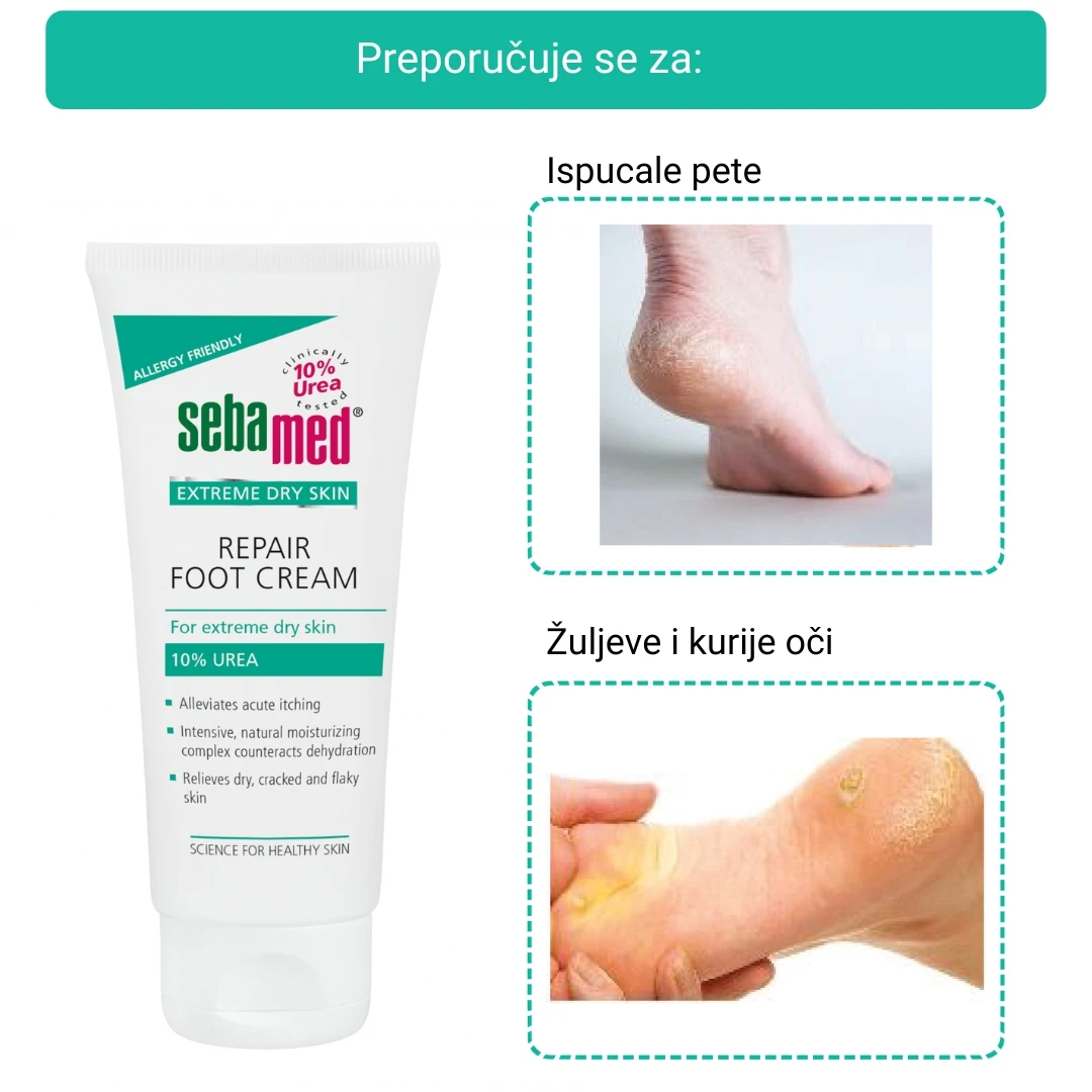 Sebamed® Krema za Stopala sa 10% Ureom za Ekstremno Suvu Kožu 200 mL